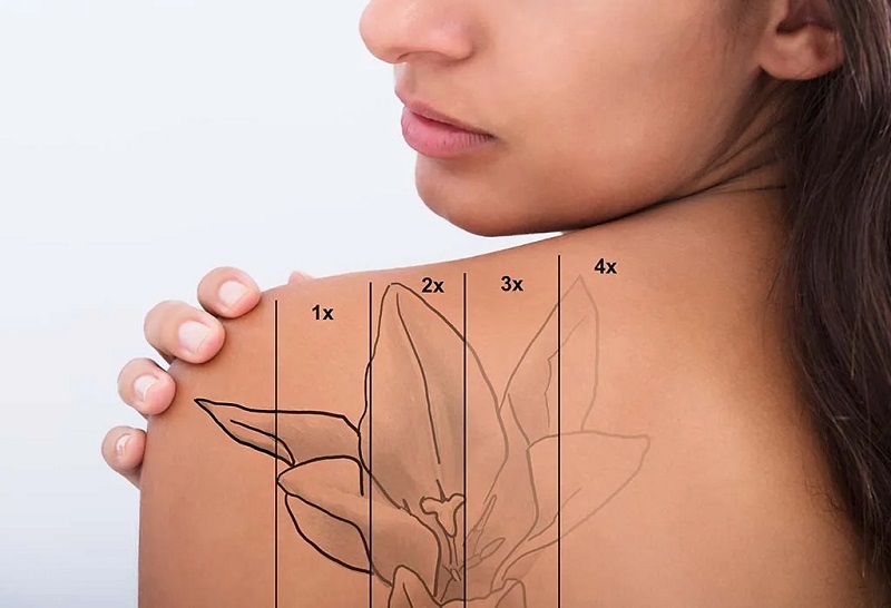 A Information to Face Tattoos – the place, why, and may they be eliminated? A Information to Face Tattoos – the place, why, and may they be eliminated?